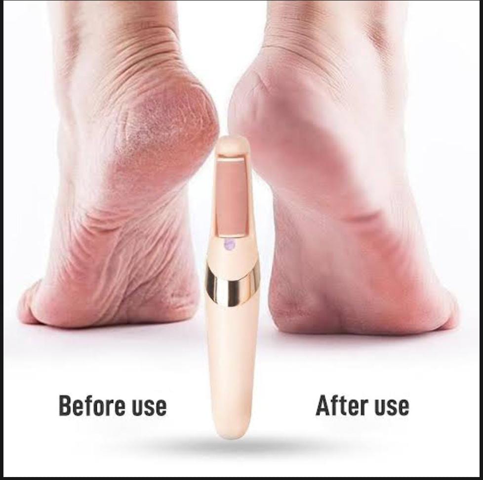 Rechargeable Electric Foot File Callus Remover Pedicure Machine Apparatus for Heels Grinding Device Foot Corns Remove Roller Feet Care Original China BIG SIZE